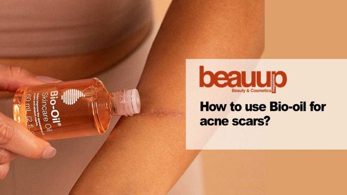 How-to-use-bio-oil-for-acne-scars-cover