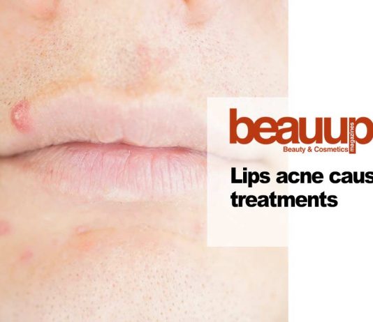 lip-acne-causes-treatments-cover